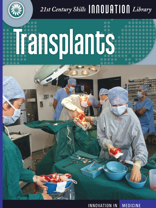 Title details for Transplants by Susan H. Gray - Available